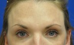 Neurotoxins