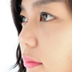 Blepharoplasty