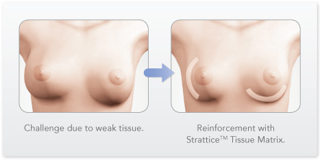 Feature-Fold-Malposition-Small
