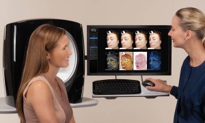 Visia Complexion Analysis For Skin Health Visia Complexion Analysis With Software