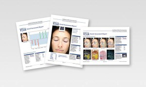 Visia Facial Assessment Report For Skin Health Visia Facial Assessment Reports Showcasing Data