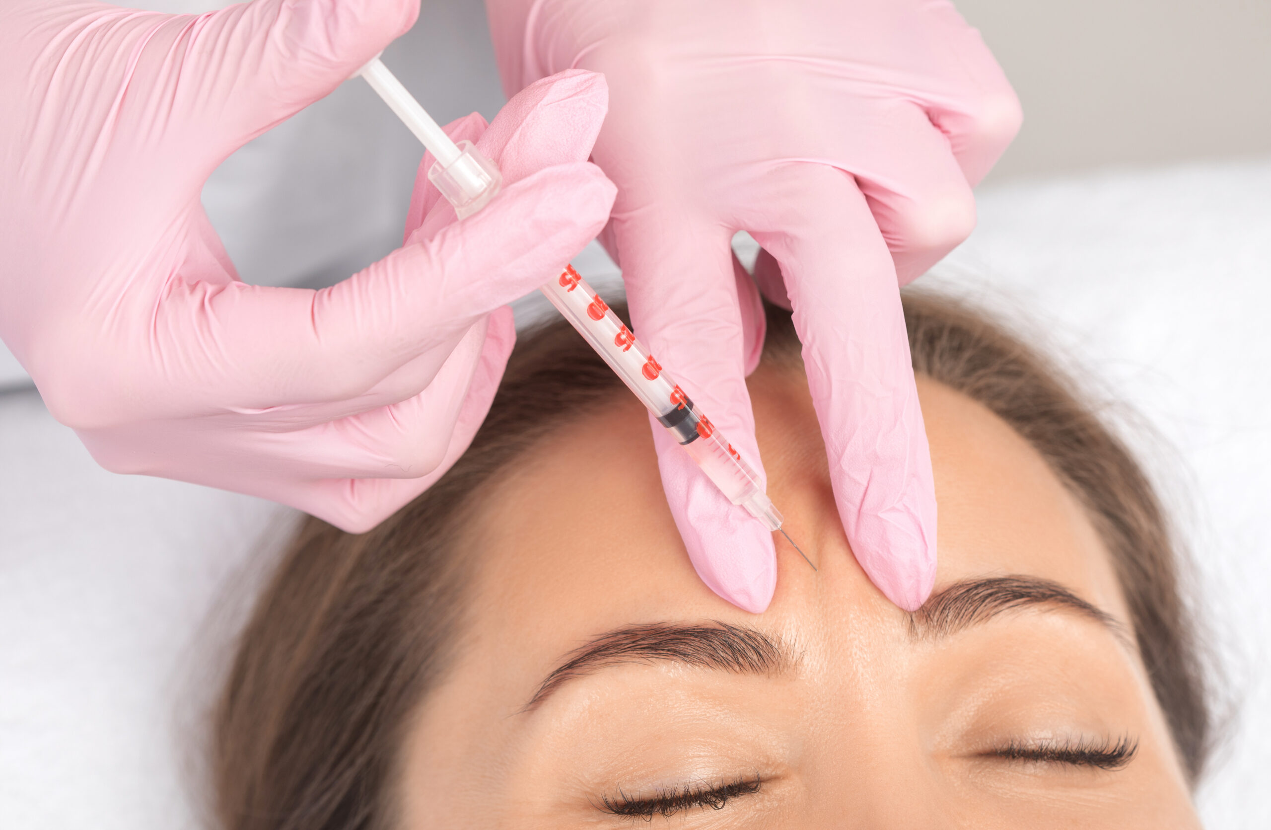 Botox For Forehead Lines